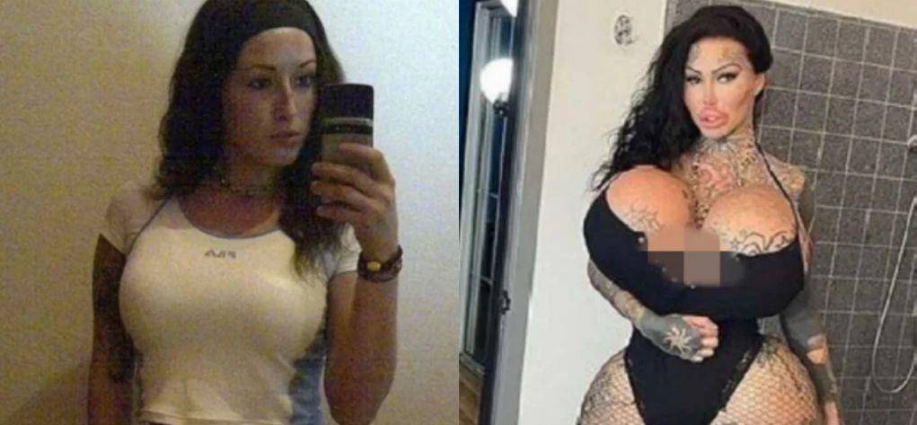 整容大国排行_意外!世界整容大国排名榜首的并非韩国,而是......