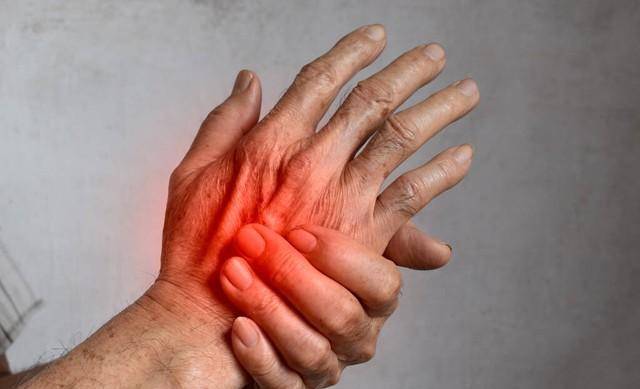 补益肝肾,祛风湿治疗类风湿关节炎_症状_寄生_屈伸