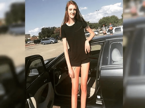 世界最长的腿的女人图片