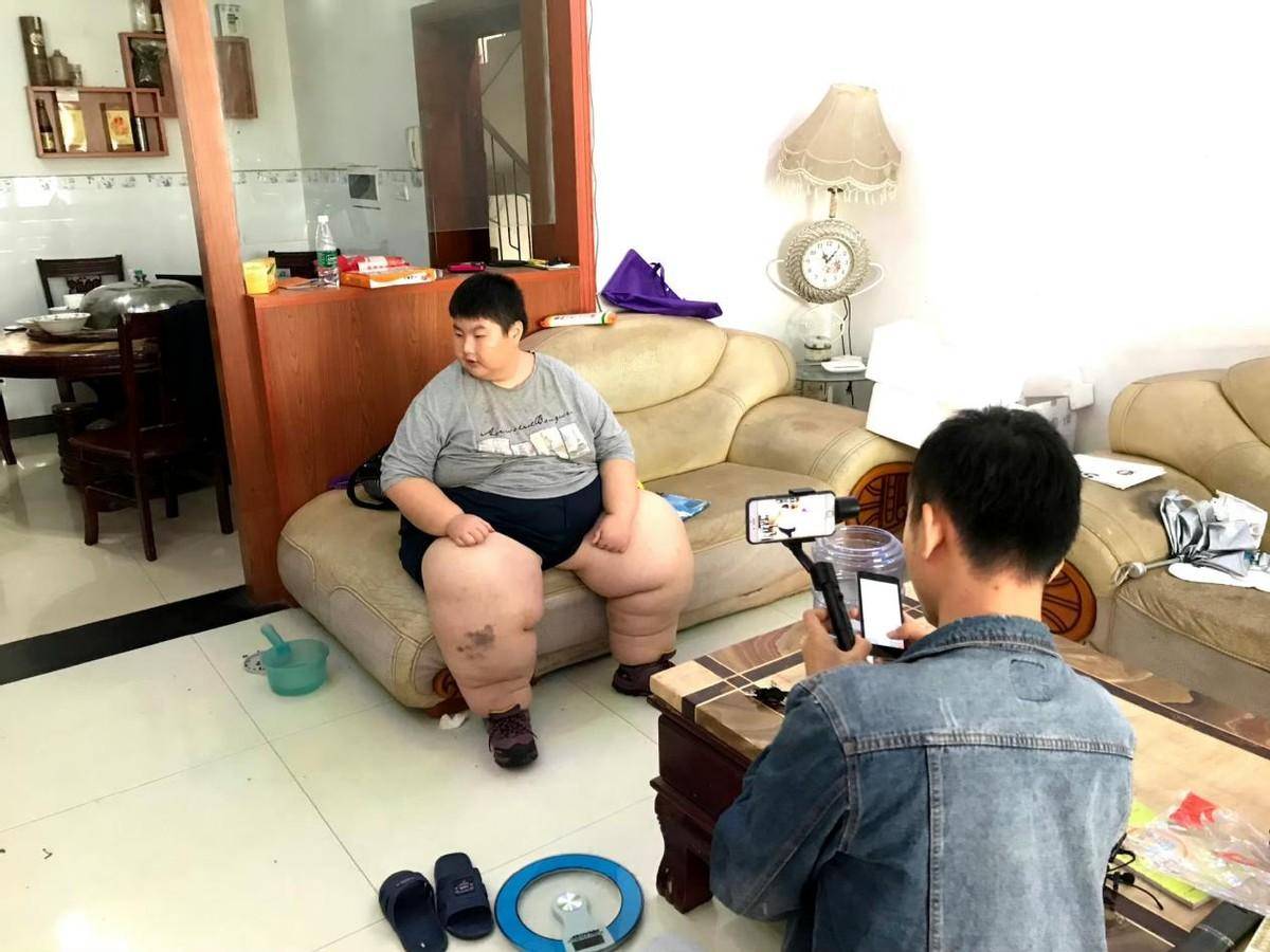 14岁男孩吃成300斤,两次切胃仍被"胖伤,能吃是福就是一个坑_徐周磊