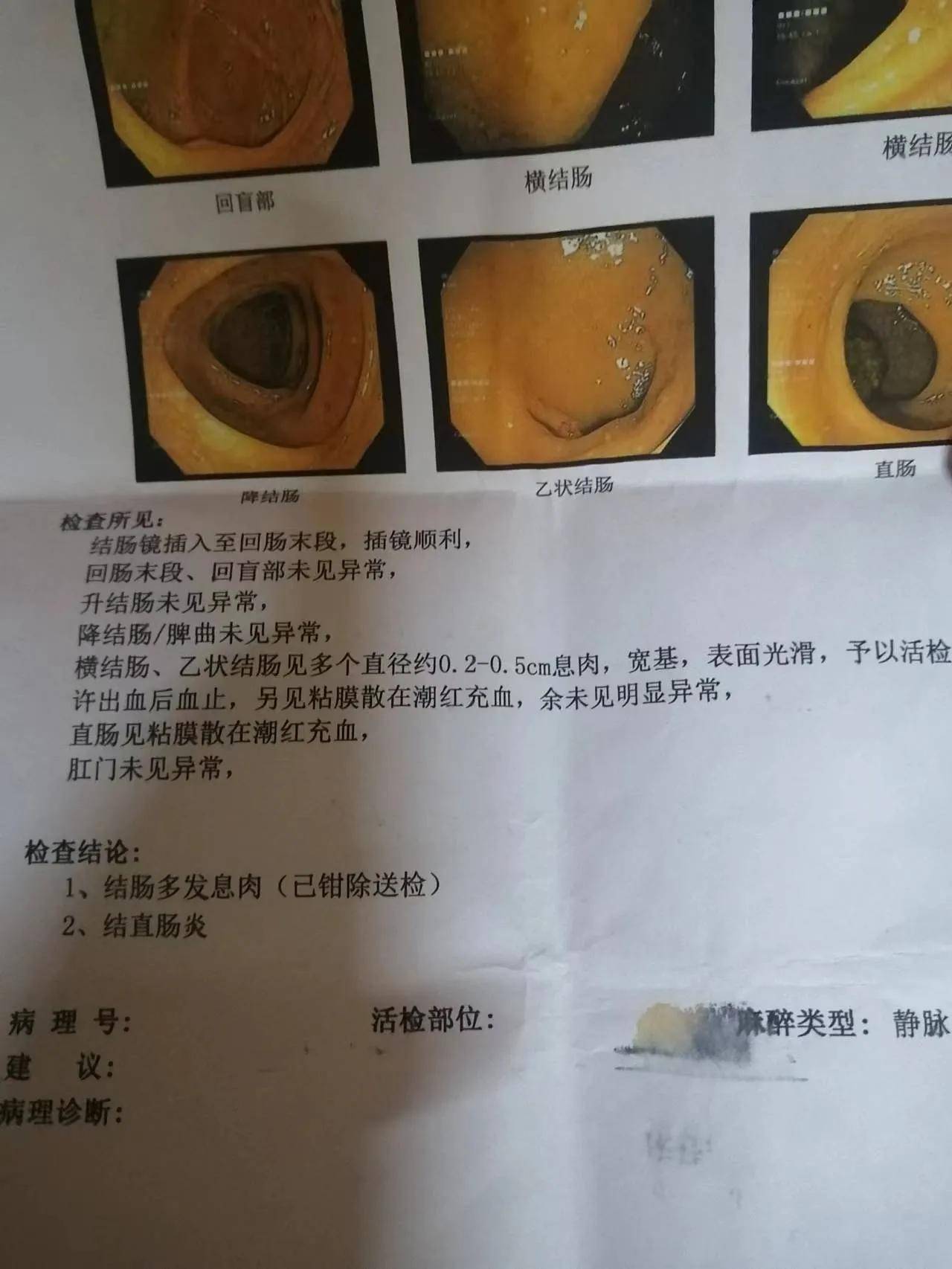 多发性肠道息肉,终于不再长了…_复查_问题_脾胃