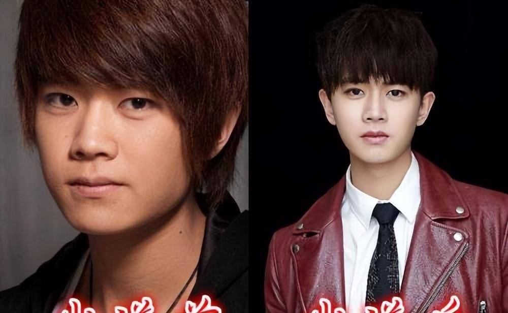 在国外做练习生,顺道微整一下,这很正常,毕竟国外明星十个有八个半