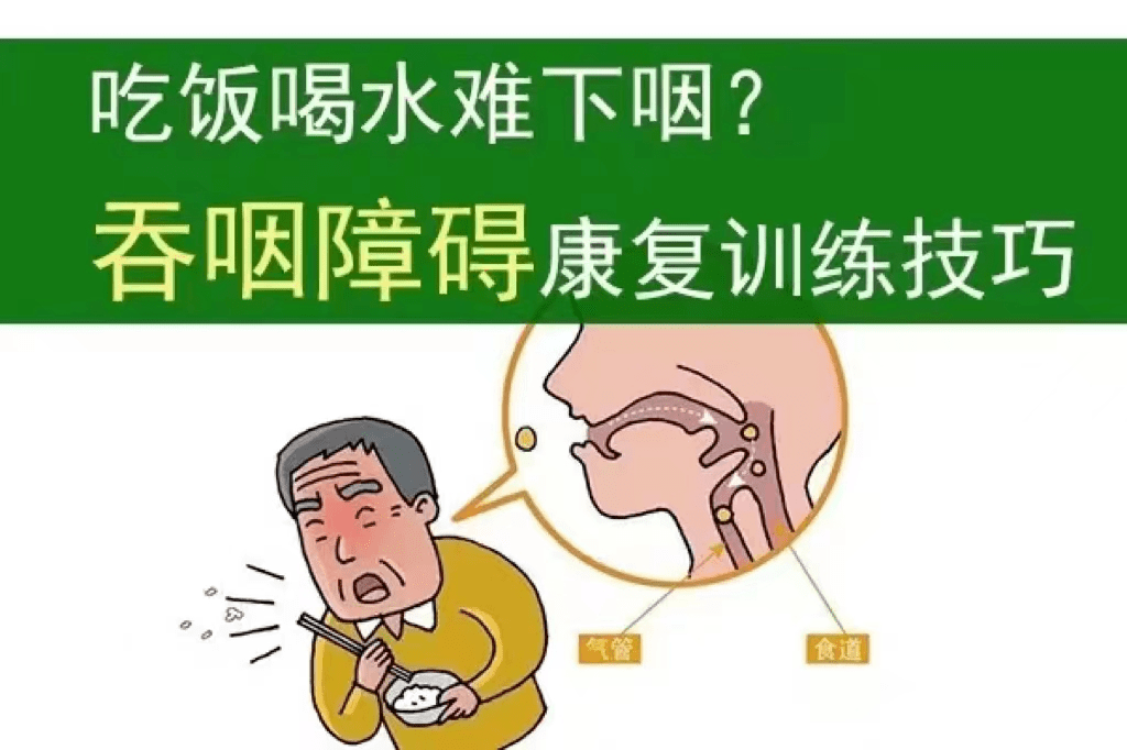 言语不清,喝水呛咳等症状——吞咽功能障碍康复技术助你恢复_训练