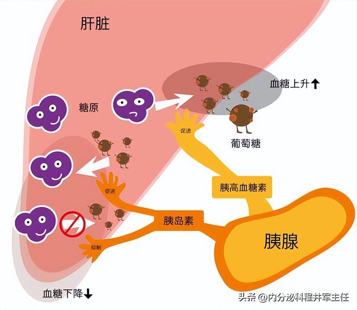 胰腺炎引发血糖急升高 一碗清胰汤