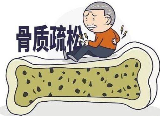 而且骨質疏鬆常見的症狀主要以腰背部疼痛多見