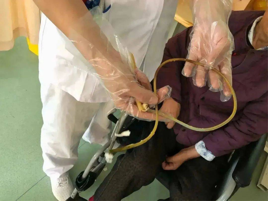 留置胃管的居家护理及注意事项,你想知道的,都在这里_服务_病人_食物