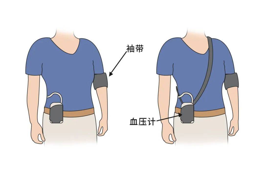 监测方法就是可以给受检者随身佩戴赛弘医用款24小时动态血压监测仪器