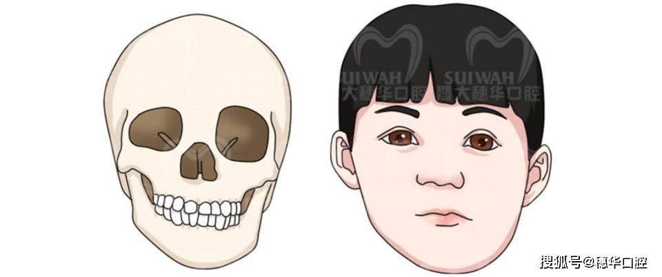 长期用左侧咀嚼脸部图图片