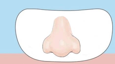 宝宝鼻尖短于鼻翼图图片
