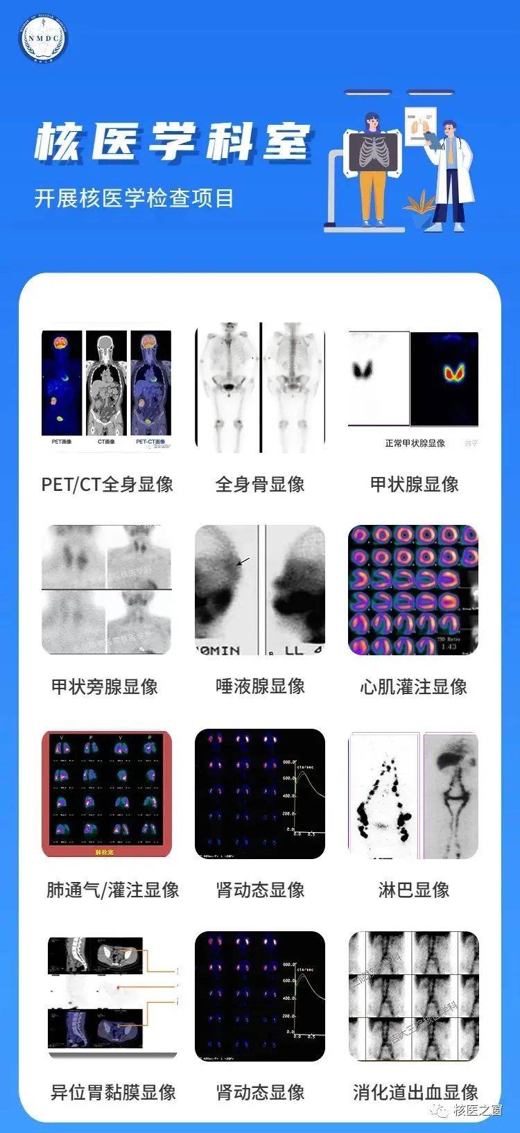 核医学唾液腺显像图片