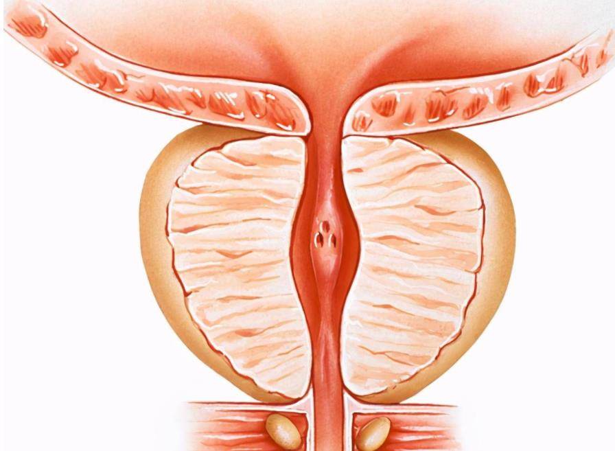 前列腺病发现就是晚期?叶定伟教授:50岁以上最好每年检查一次_筛查_男