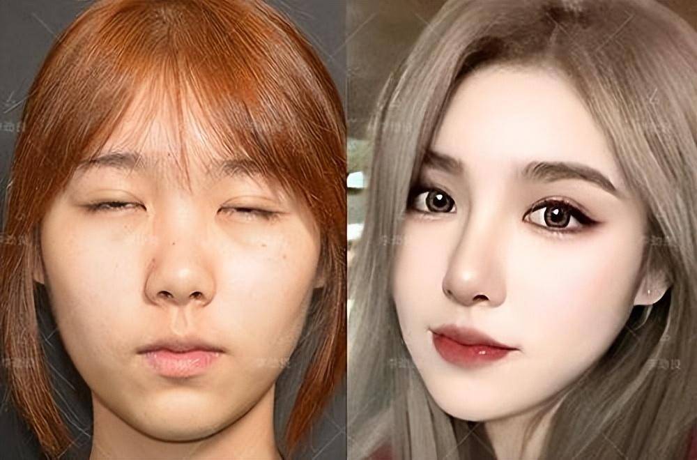 主要原因是眉弓!_眉骨_美学_整形