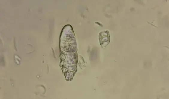 莫爱佳皮肤关爱月病例回顾——猫戈托伊蠕形螨感染,浅表性脓皮病的诊