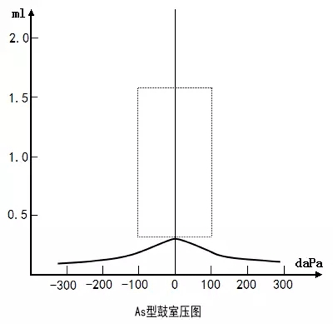 绵阳聪茂听力分享:三分钟读懂声导抗之鼓室图测试_ml_中耳_外耳
