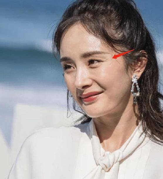 当34岁杨幂离开精修后,眼部鱼尾纹尽显老态,少女人设也要崩塌_按摩
