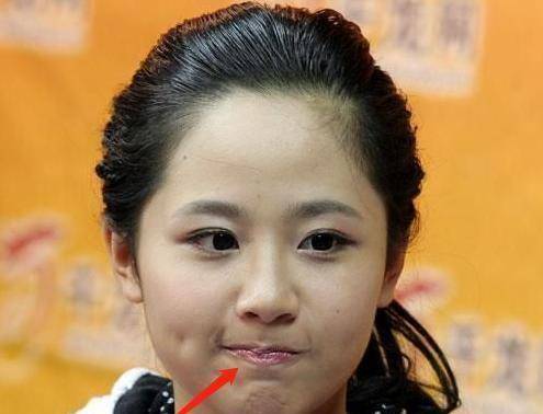 看了杨紫的近照,真是让人心疼,唇纹深还起皮,网友:别嘟嘴了!