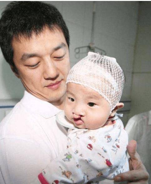 李嫣高调现身街头,三次兔唇修复后,路人镜头下手术痕迹明显