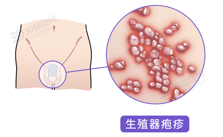 正常男性分泌物图片图片