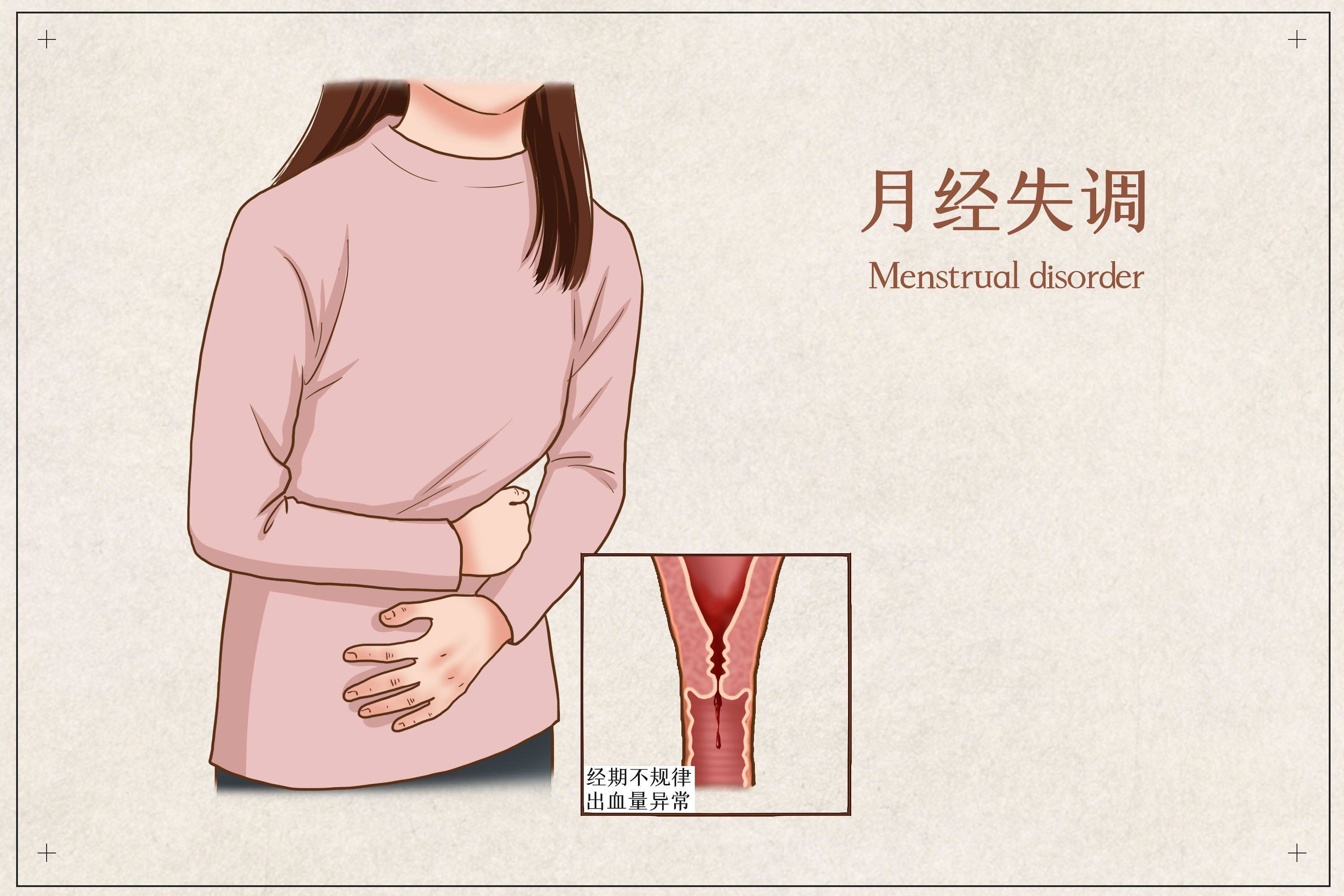 谷方益元健康顾问:一篇文章给女性讲透月经不调_进行_身体_穴位