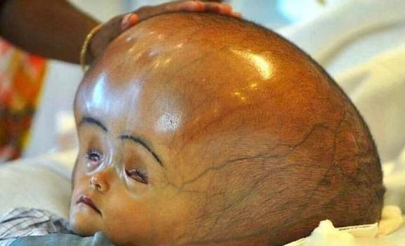 孩子的头大,头小,偏头,方颅,是什么原因?一次性弄清楚!