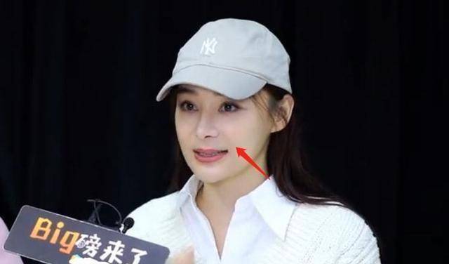 袁姗姗最新采访变样,撞脸姚笛又像杨幂,发际线后推抢镜_鼻子_变化