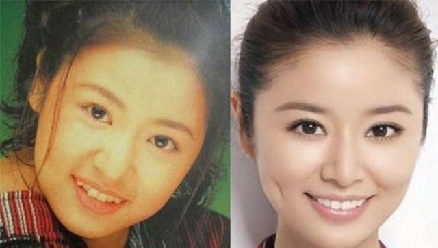 有"虎牙",张雪迎佟丽娅好美,她太丑偷偷做矫正_李宇春_时候_马伊琍