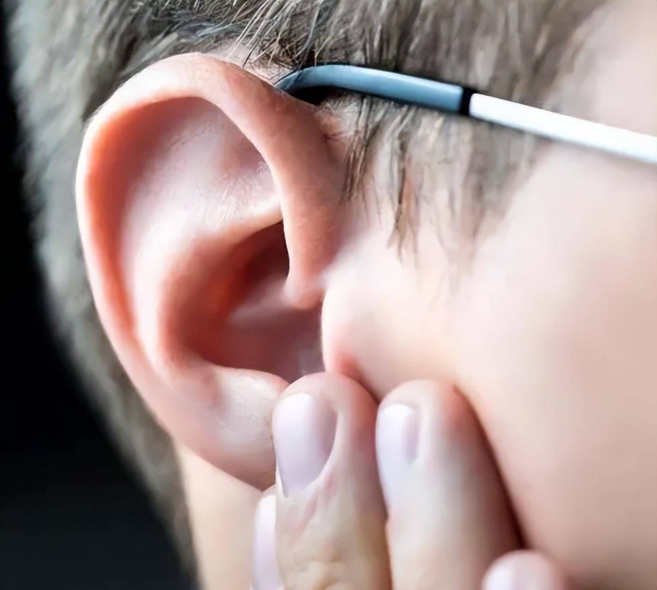 三星耳机导致耳部感染图片