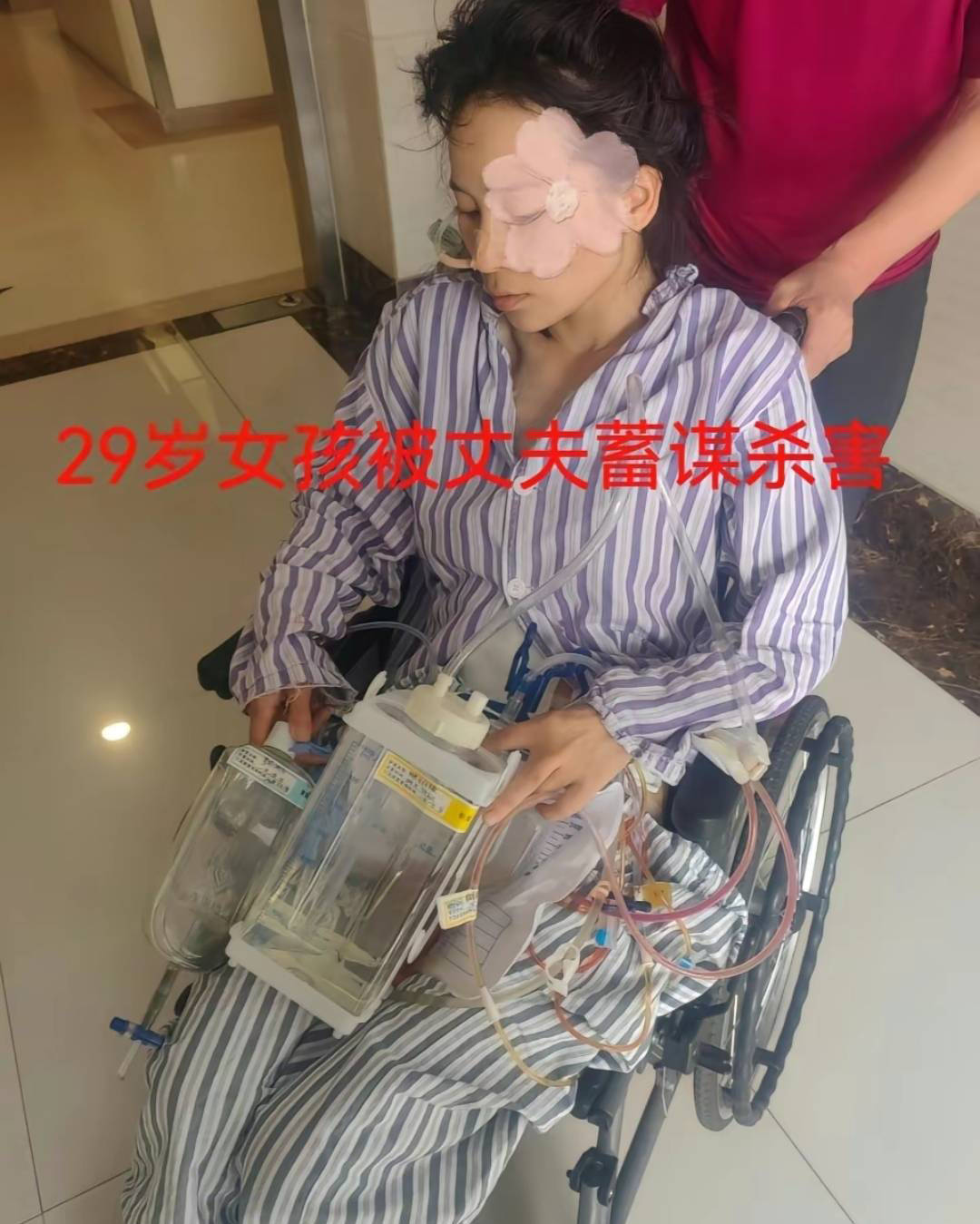 女子被家暴16次后申请离婚,被婆家人设套灌醉,被殴打致失去脉搏_丈夫