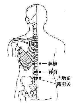 [處方]:腎俞,大腸俞,秩邊,環跳,承扶,殷門,委中,陽陵泉[功效]:疏經