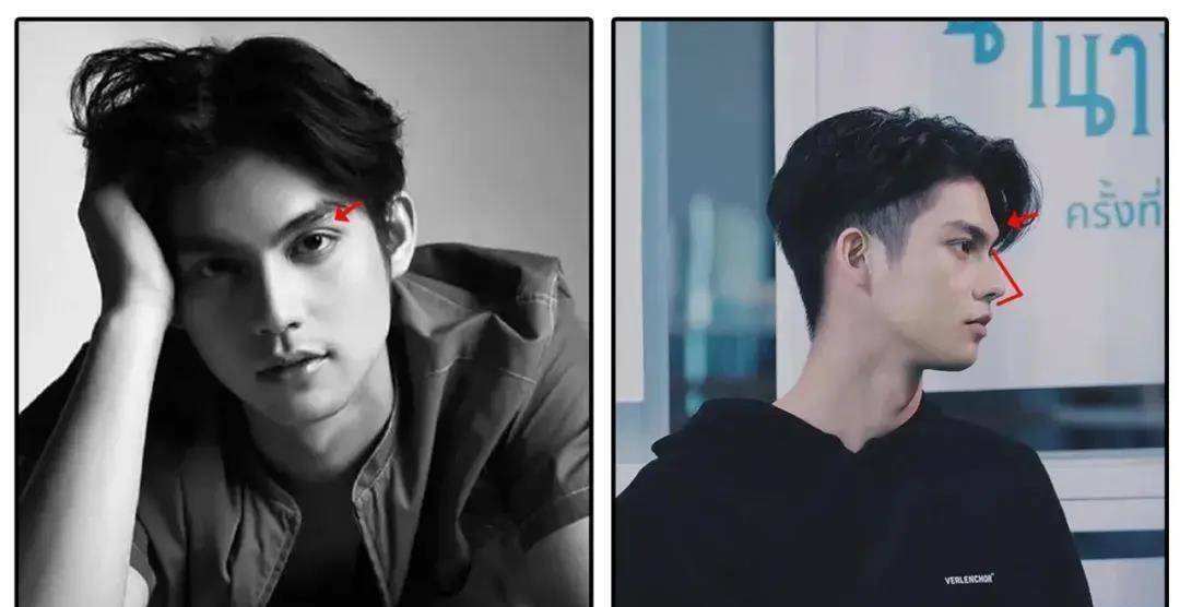 巴掌窄长脸,高眉骨,高鼻梁,深眼窝,欧化的五官轮廓立体感十足,眉压眼