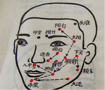 病根埋线调理面神经麻痹疾病的思考——面部神经的分支,肌肉支配,穴位