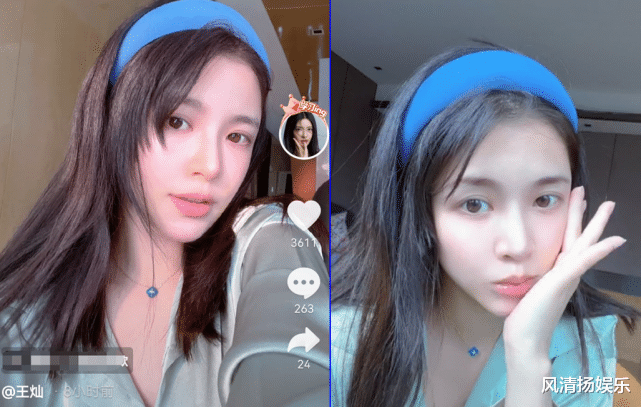 王灿晒素颜照被赞,双眼皮有疤被疑整容,角落玩偶近7万穿戴贵气_杜淳跟