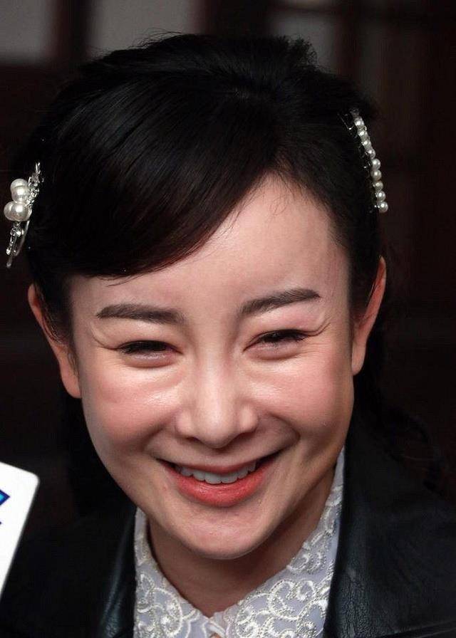 从初见玻尿酸到脸部凹陷再到浮肿满面看过的都开始心疼张檬这张脸了