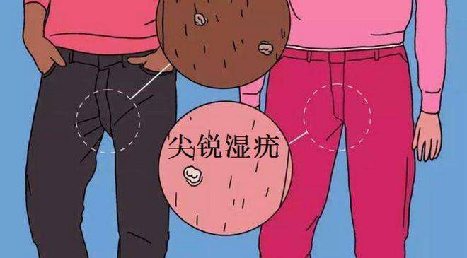 资讯|赵晓军医生科普:尖锐湿疣患者怎样做好自身调理?_治疗_疾病_发病