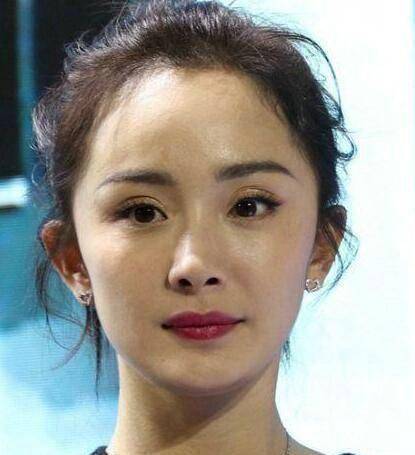 天生双眼皮和"人造"双眼皮有什么不同?