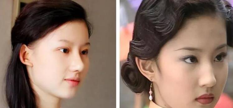 9年前,那个把自己整容成"刘亦菲"的女孩,后来怎么样了_李静涵_成功