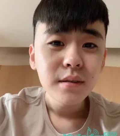 张云雷手术后晒自拍精神面貌佳身体恢复情况良好_成功_舞台_救治