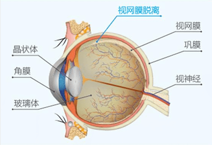 这几种【眼底病,请一定一定要知道!_视网膜_病变_患者