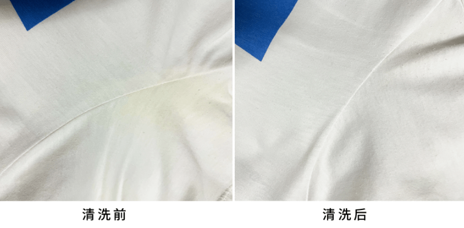 不管枕套、衣领汗渍多重，教你5个小妙招，一洗就干净_衣物_洗涤剂_方法