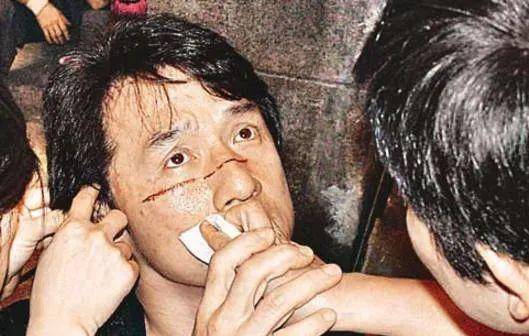 曾志伟看到成龙情况严重,觉得他可能快死了,就赶紧给嘉禾大老板邹文怀