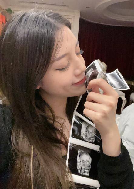 兜儿晒四维b超图,用小号尬吹,称孩子长得好看遗传了她的基因_父母