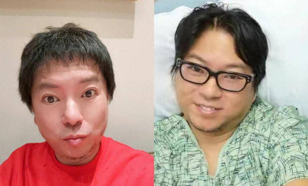 53岁高晓松晒近照暴瘦,网友直呼认不出,疑过度医美撞脸华晨宇_减肥