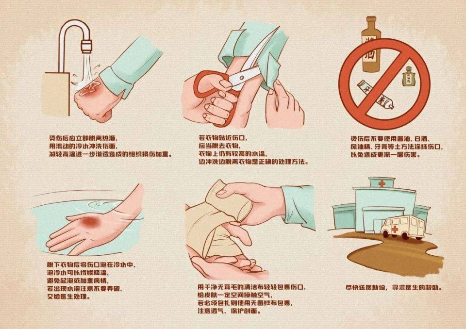 烧烫伤的应急处理与伤口治疗,中腾生物带你了解_创面_生产_皮肤