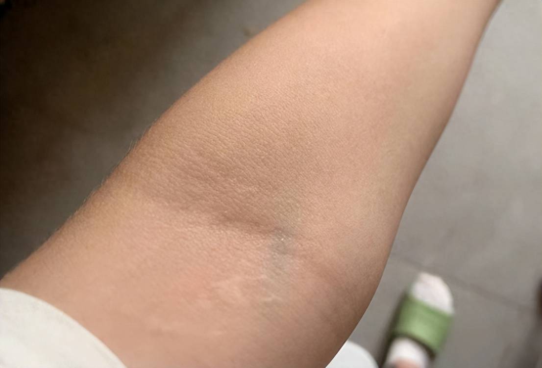 手肘胳膊酸痛无力?赶紧来学这几个方法,摆脱疼痛巨简单!