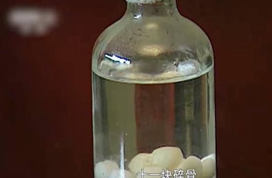 从膝盖当中取出了11块碎骨,刘玉栋依旧说道:我打不好可以,但是我不能