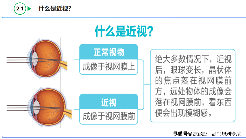 考警校提前多久做近视手术?报考军校和警校什么时候做眼睛近视手术合适