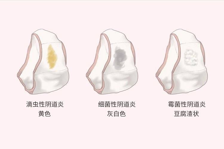 多和这4个原因有关_阴道_长度_气体