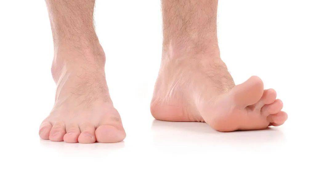 5个小妙招,或能帮你缓解脚气!_效果_时候_足部