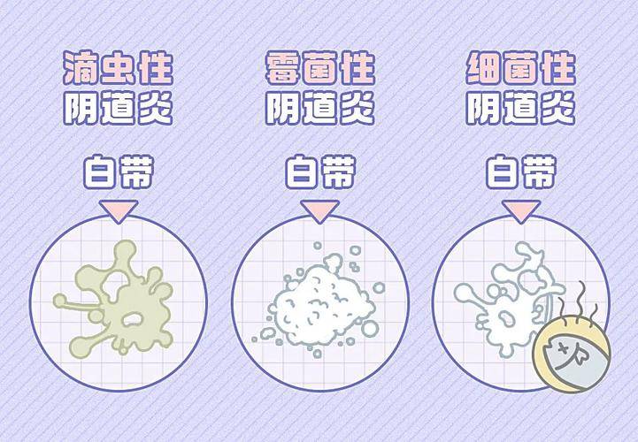 为什么阴道水少