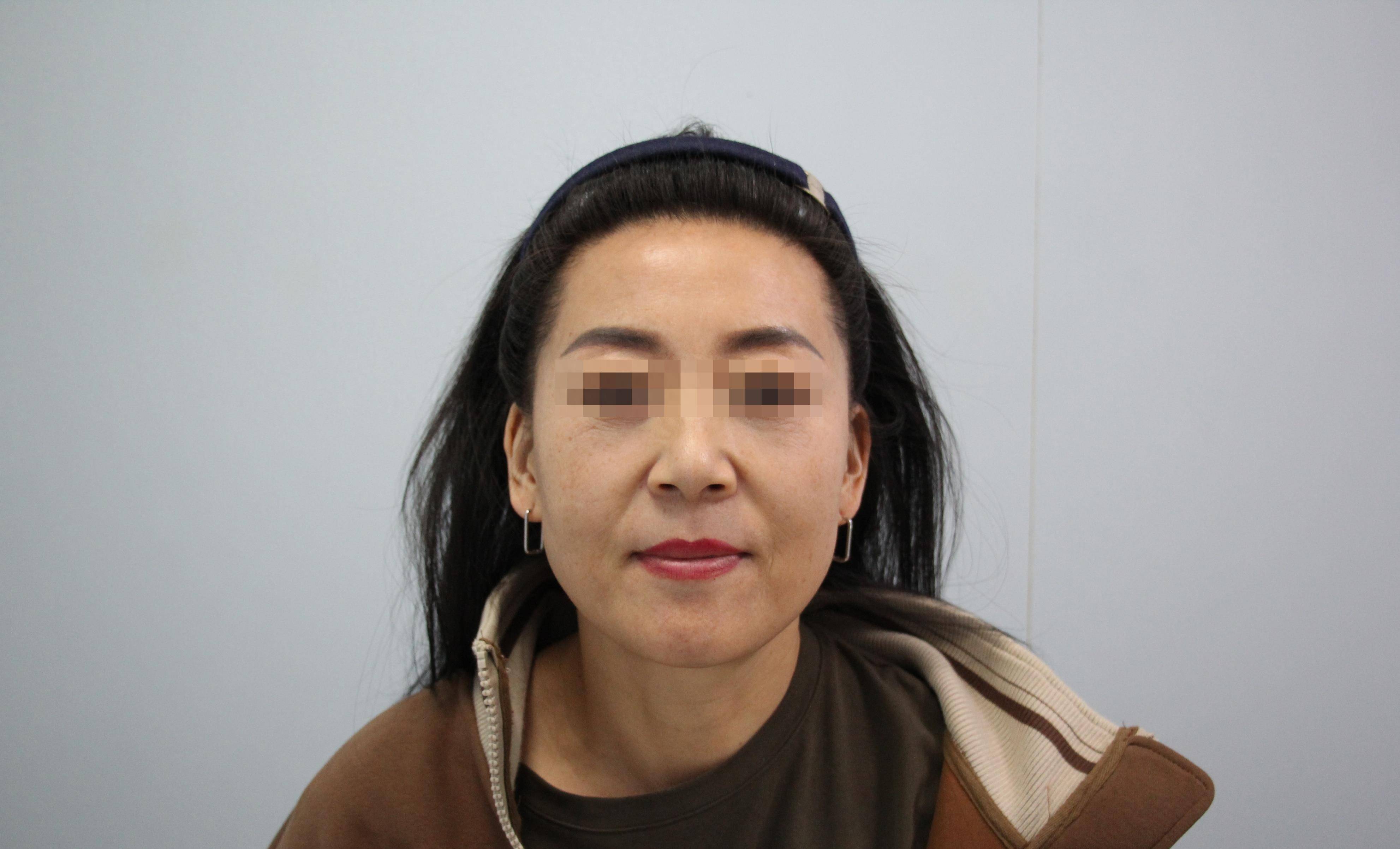 48岁的弗拉基米尔·大姐选择了整容,看看之前和之后的对比,效果惊人
